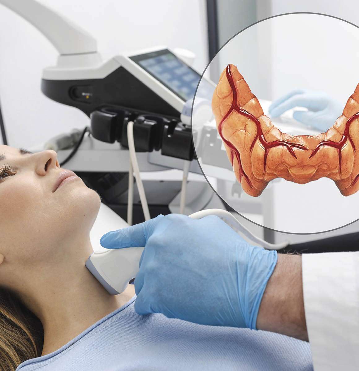 Thyroid Elastography Euromedica thyroid-elastography-euromedica