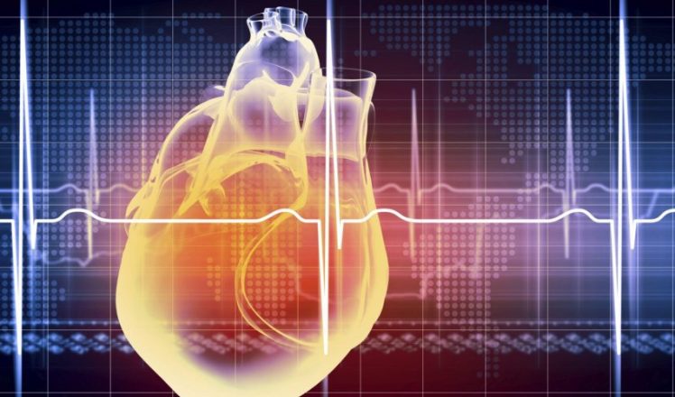 ECG