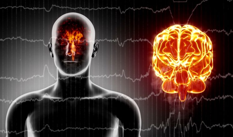 EEG